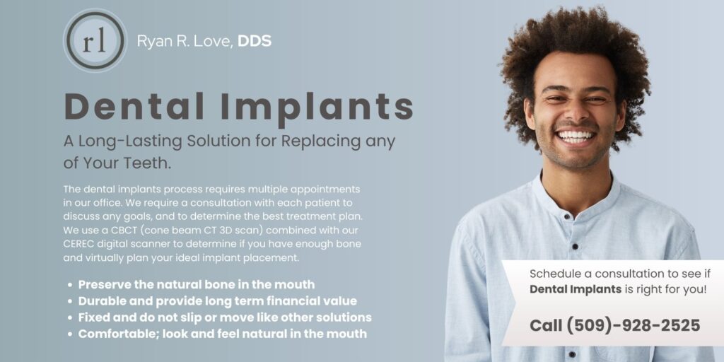 DentalImplants1